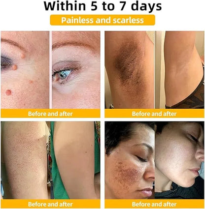 Zidella Skin Lighting Blemish Cream (50 g)