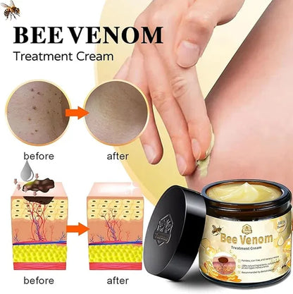 Zidella Skin Lighting Blemish Cream (50 g)